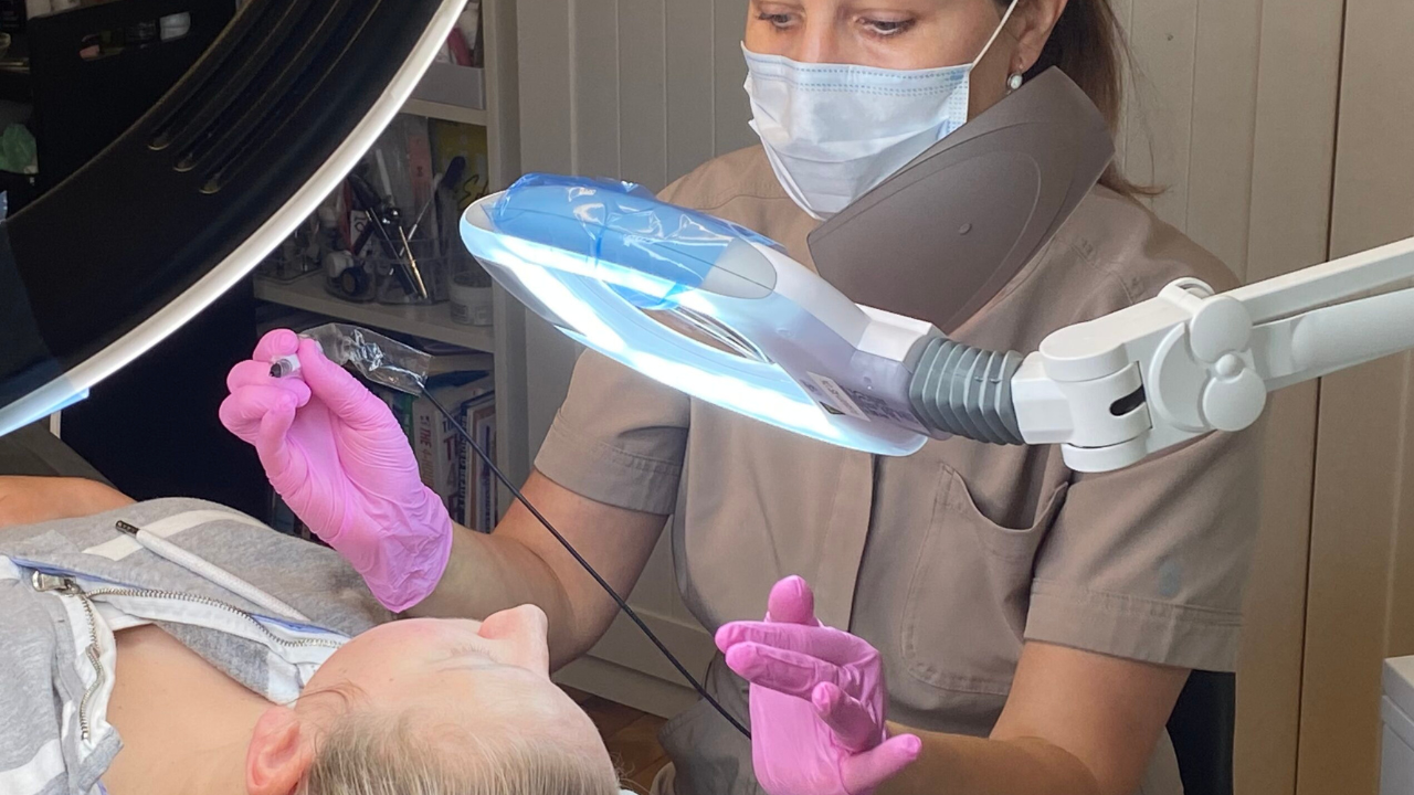 Microneedling